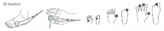 Sensore SpO2 Meditech (Sonda ossimetro di polso a fascetta)